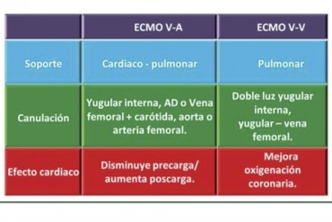 ecmo.jpg